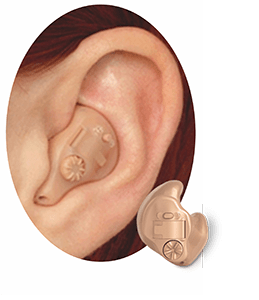 Tipos de aparatos auditivos